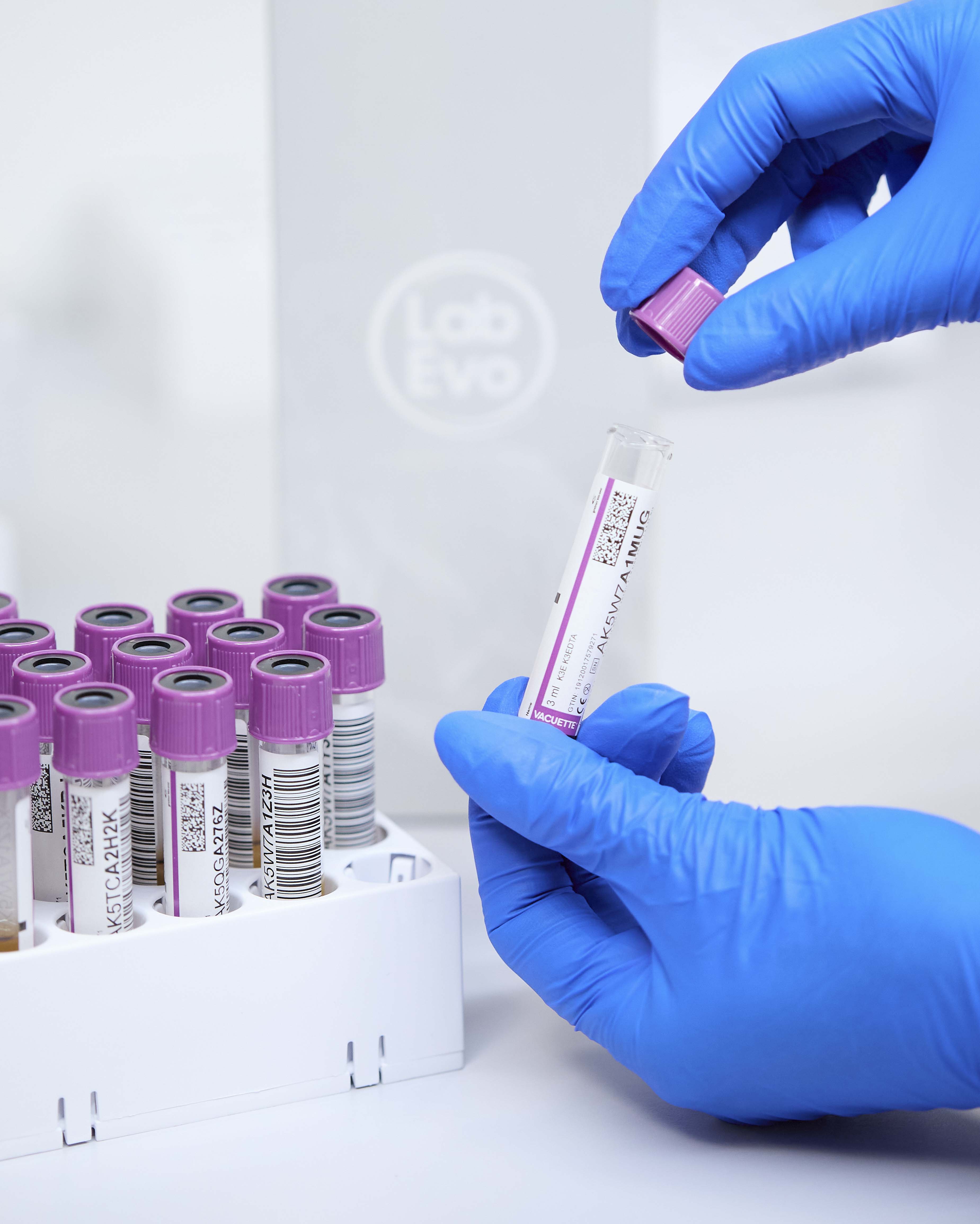 mani con guanti nitrile aprendo provetta con tappo viola