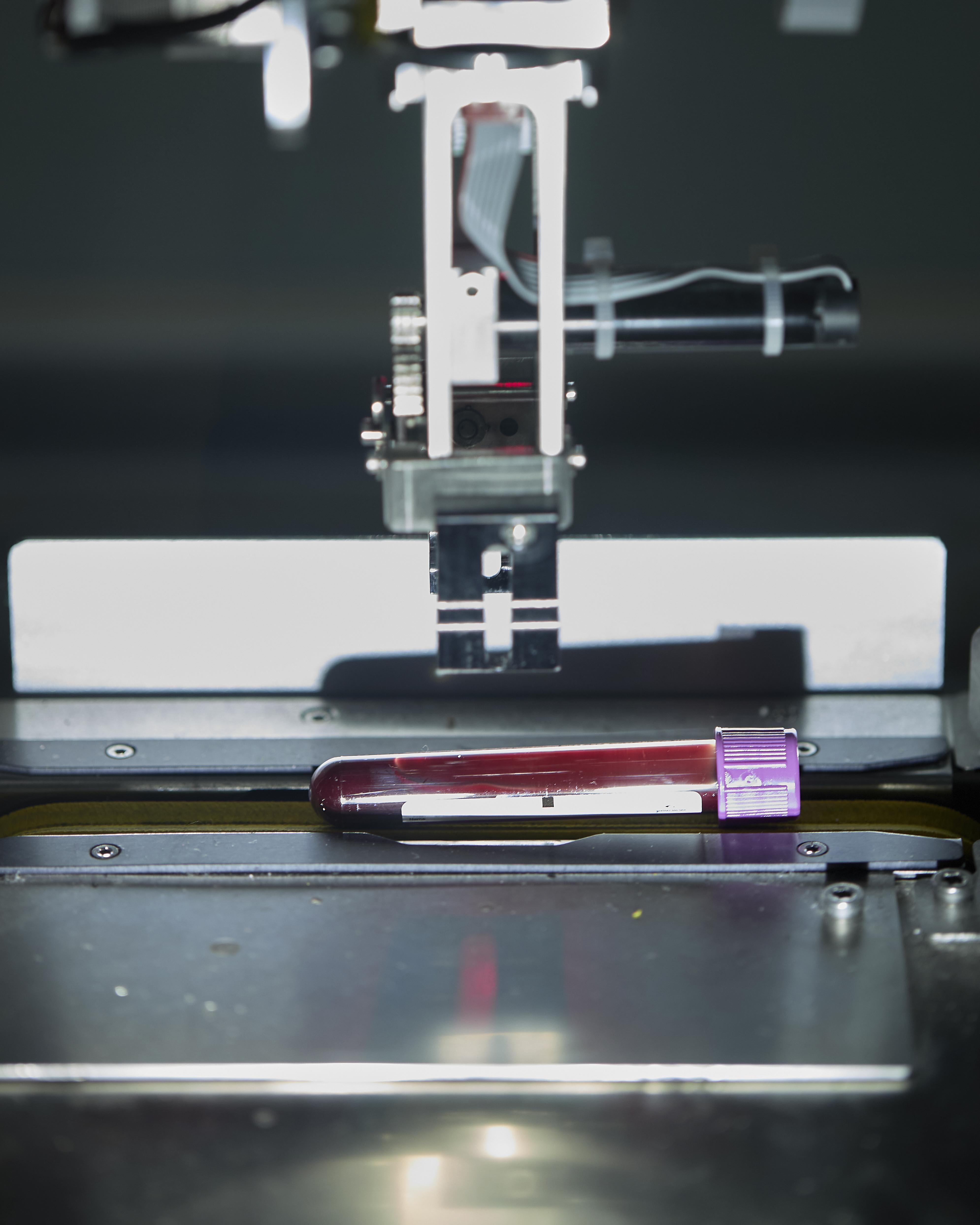 close up di apparecchiatura per analisi ematiche con provetta in primo piano