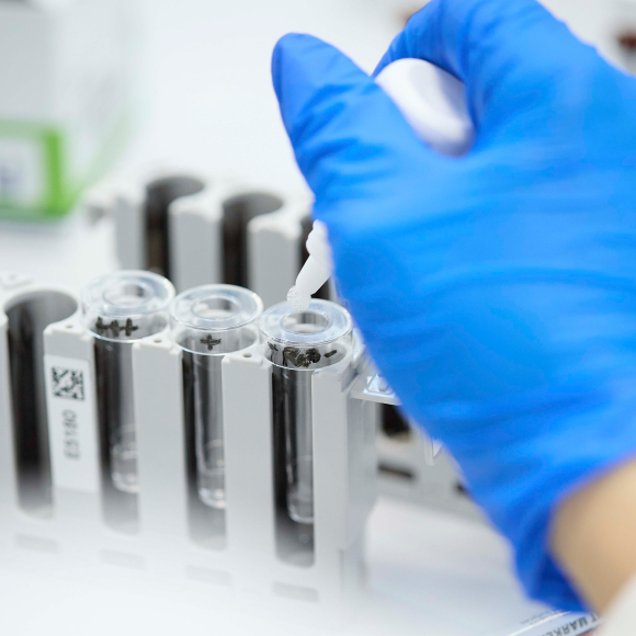 mano con guanti blu di specialista manipolazione provette